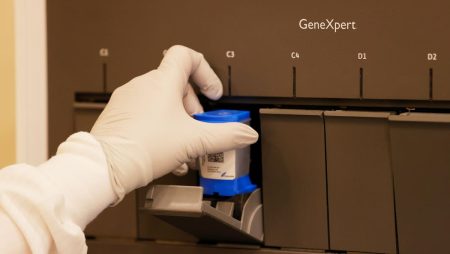 Danaher Lowers Price Of Tuberculosis Test After Pressure Campaign